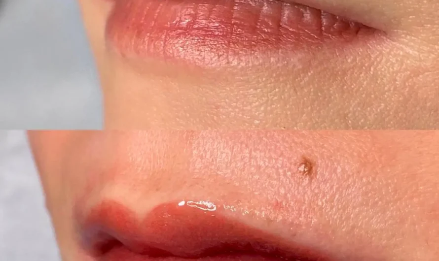 What size tattoo needle for bold lines?